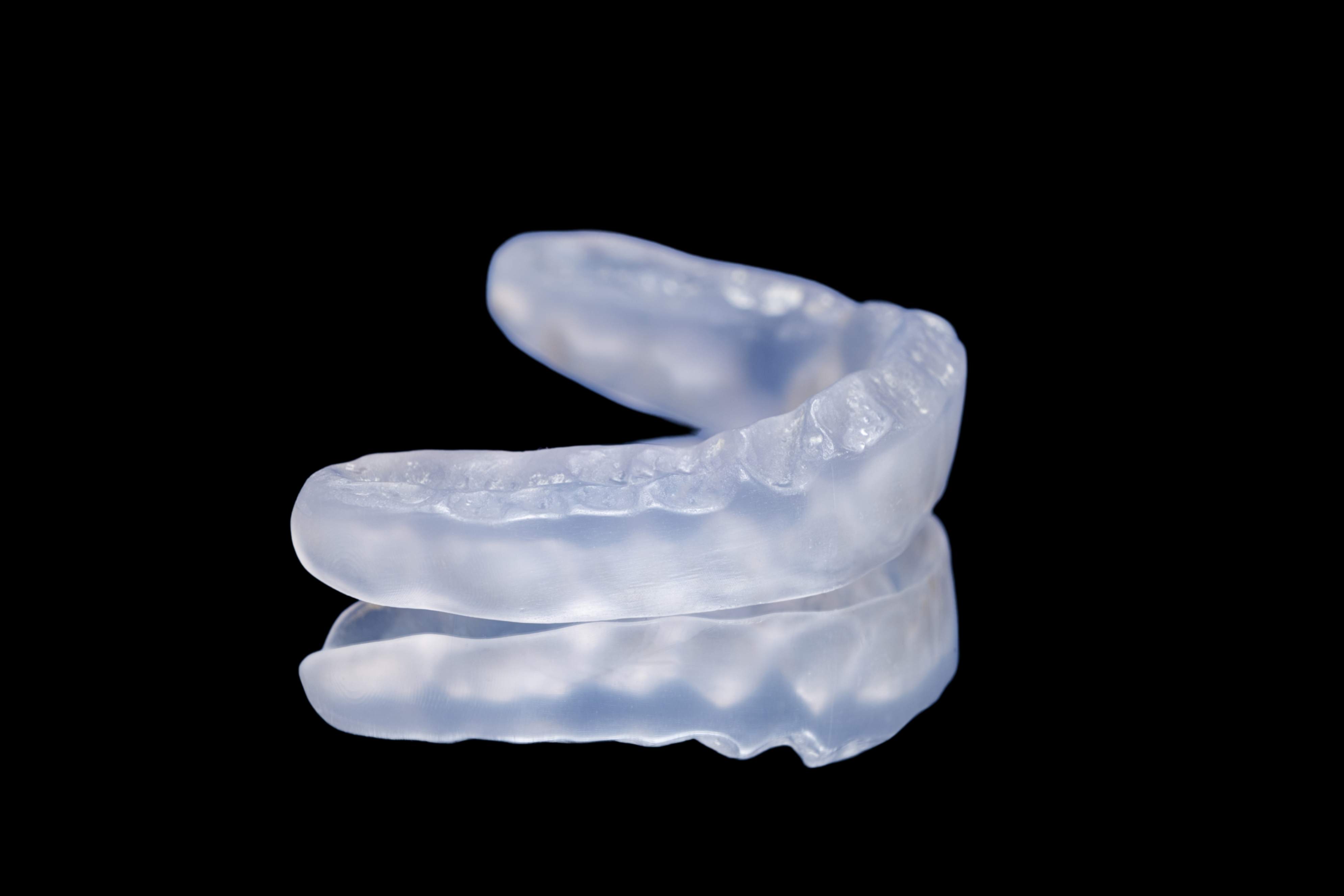 articolazione temporo mandibolare