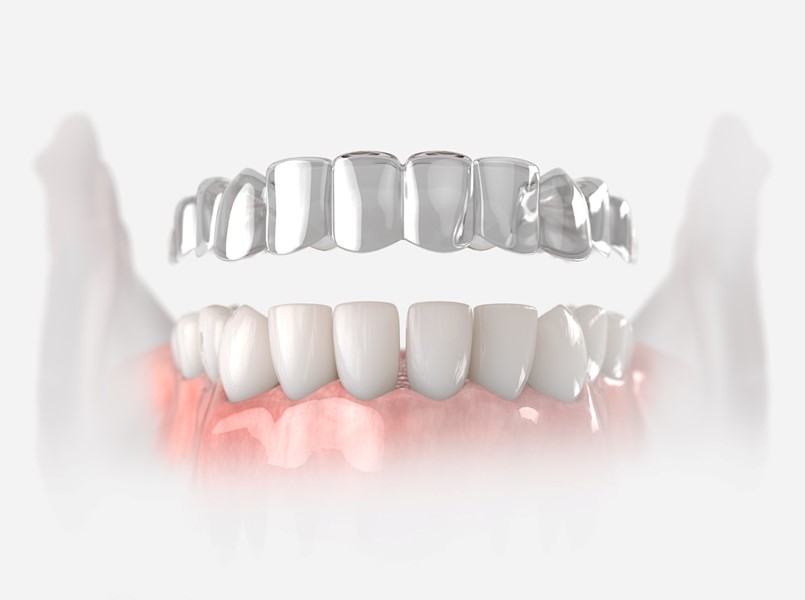 bite dentale per rilassare muscolatura