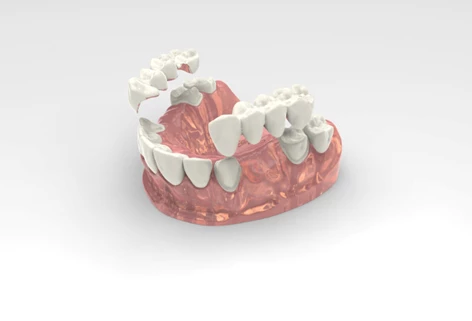 ponte dentale croazia