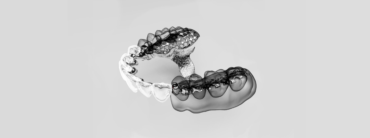 protesi mobile parziale scheletrata