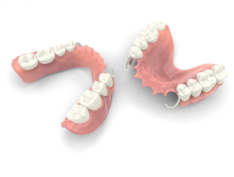 protesi mobile parziale
