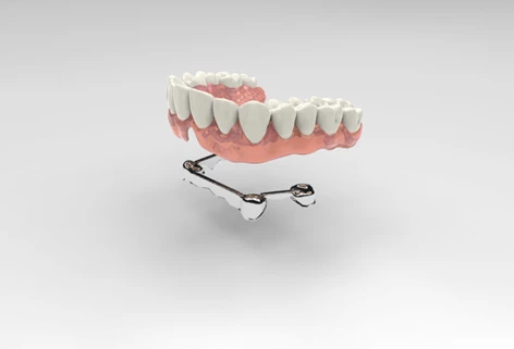 protesu su impianti croazia